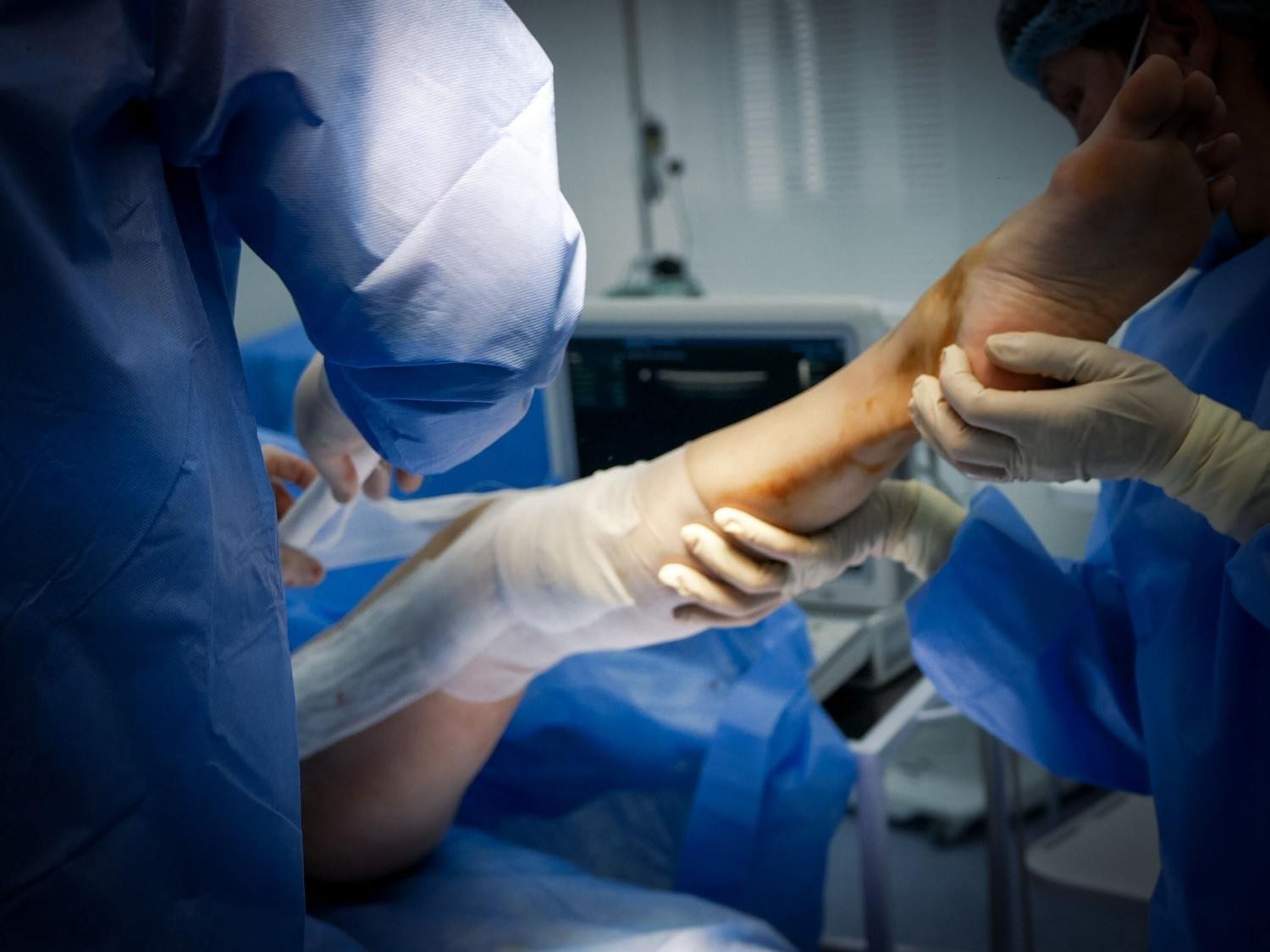 Revision Joint Replacement Surgery in Delhi