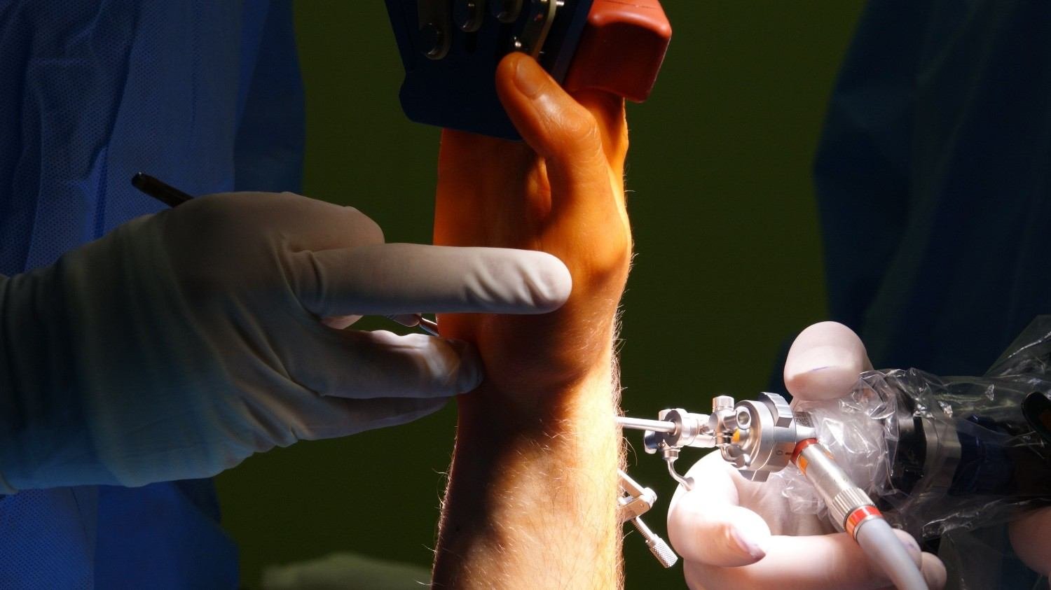 Arthroscopic Surgeon in Delhi